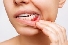 What Causes Gum Pain?